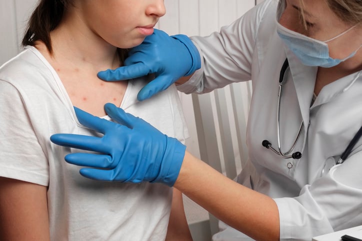 doctor checking a patient with measles